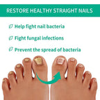 Nail Fungus Solution, Anti Infection Nail Fungus Removal Gel, Ingrown Toenail Treatment Nail Care Oil, Nail Fungus Treatments Serum