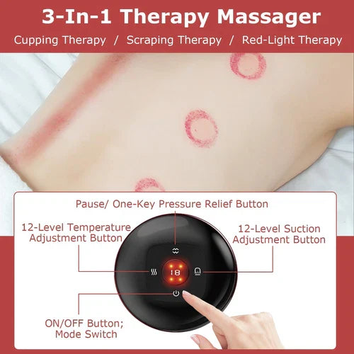 Electric Cupping Massager with Infrared Therapy – Pain Relief & Muscle Recovery